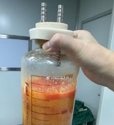 惠州水动力吸脂手术要做多久？